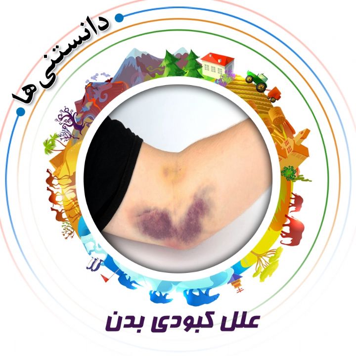 جلد کتاب صوتی علل کبودی بدن