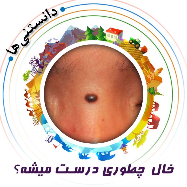 جلد کتاب صوتی خال چطور به وجود می آید؟